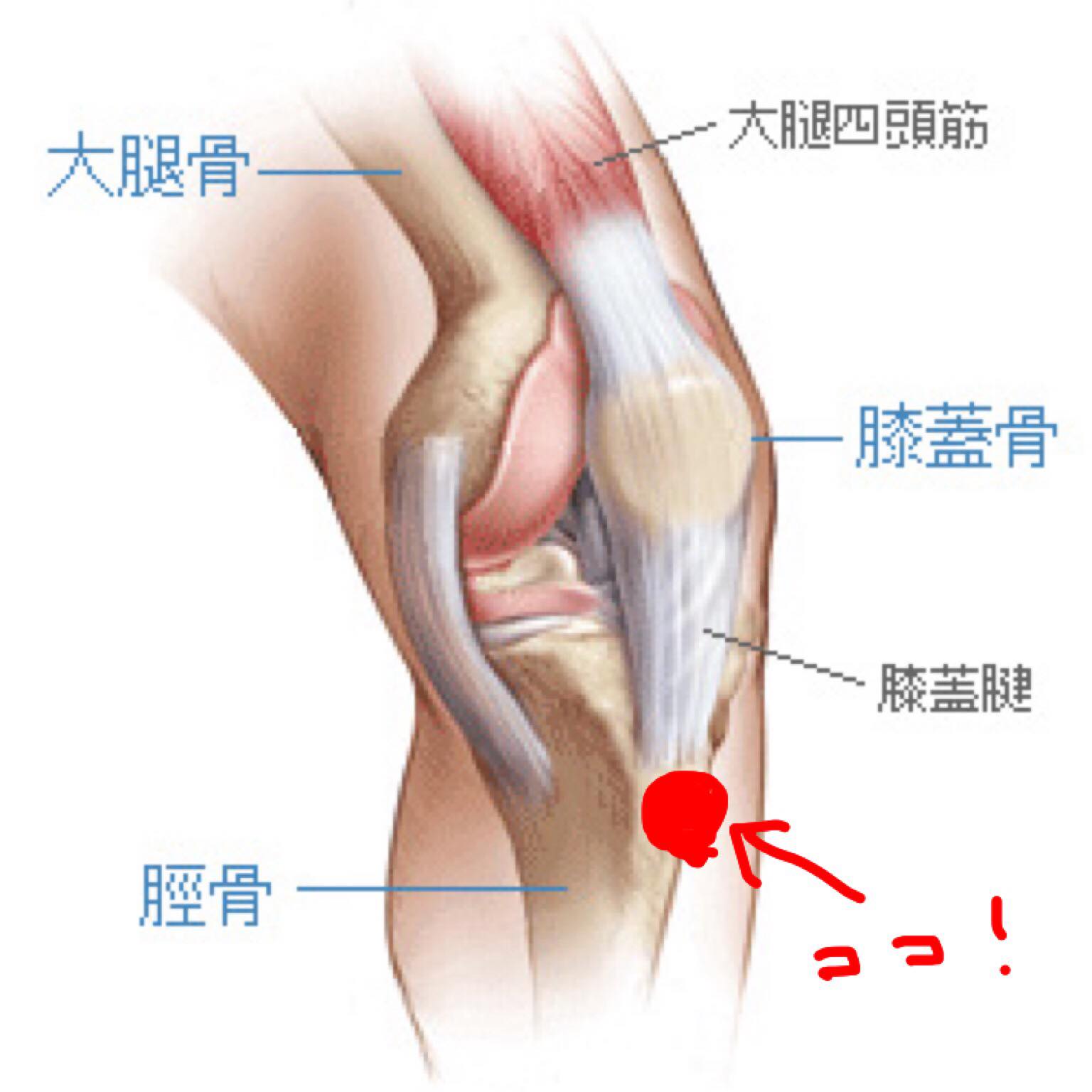 脛骨粗面